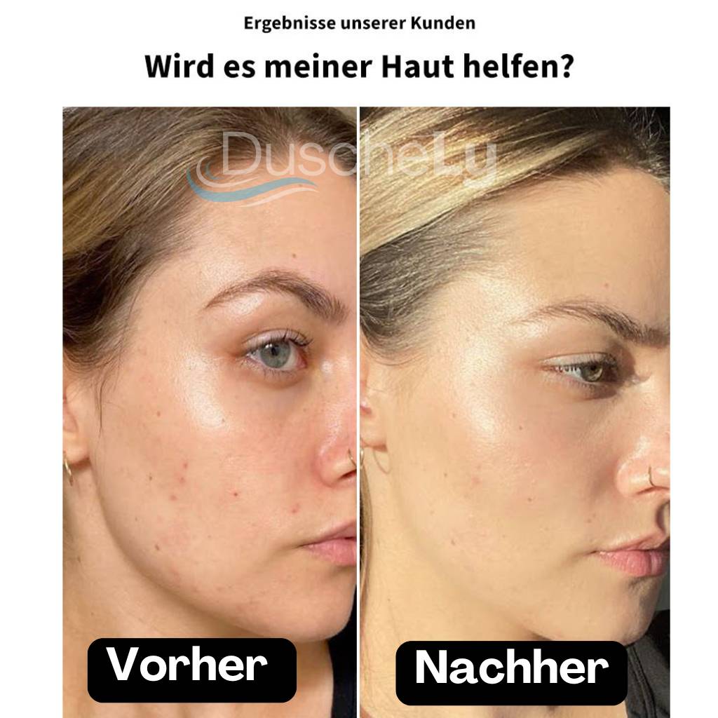 DuscheLy™ Gefilterter Duschkopf