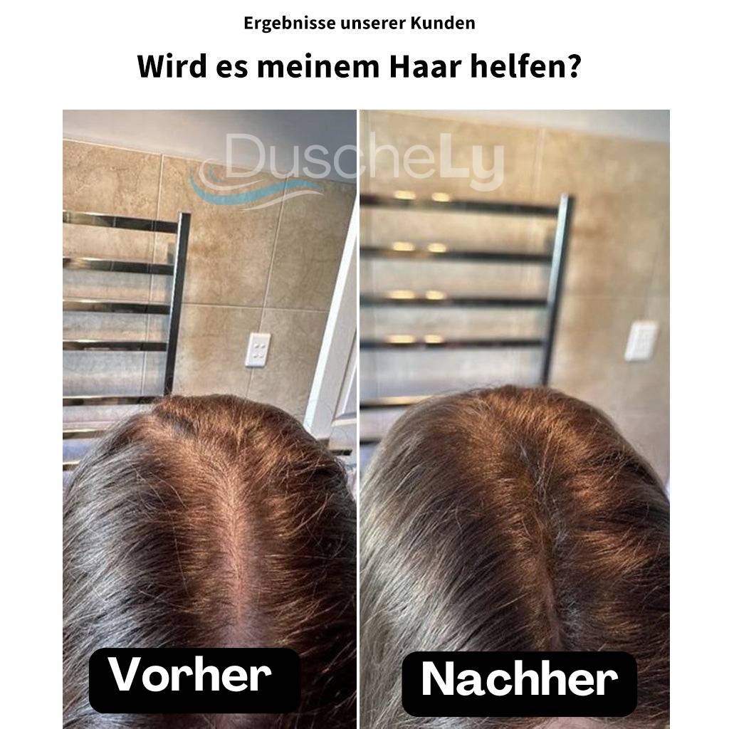 DuscheLy™ Gefilterter Duschkopf