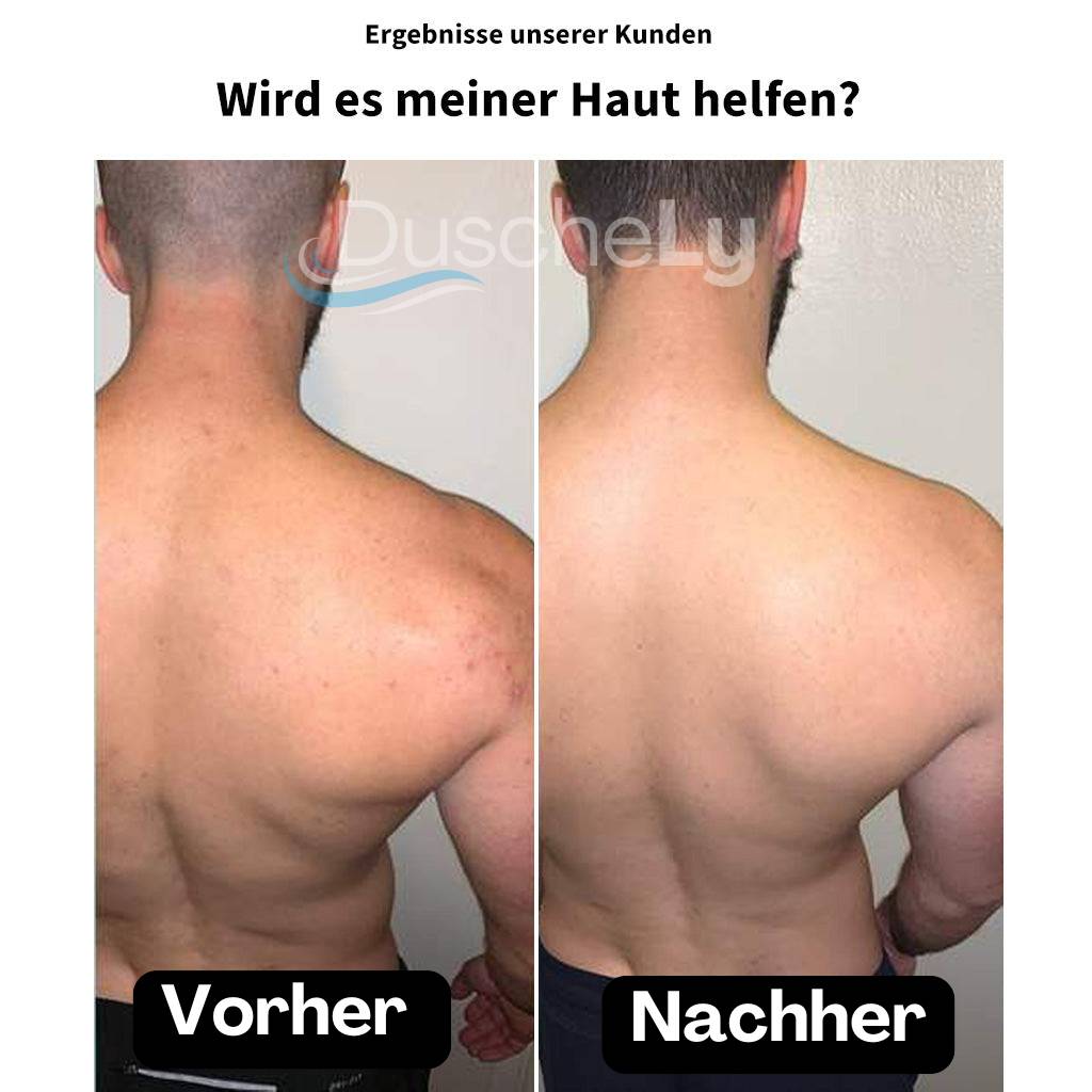 DuscheLy™ Gefilterter Duschkopf