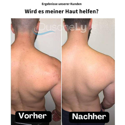 DuscheLy™ Gefilterter Duschkopf